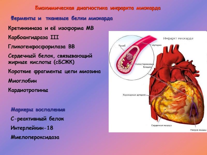 Биохимическая диагностика инфаркта миокарда Кретинкиназа и её изоформа МВ Карбоангидраза III Гликогенфосфорилаза ВВ Сердечный